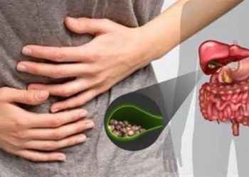 كيف تحمى نفسك من التهابات المرارة