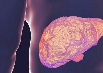 أعراض تقدم تليف الكبد