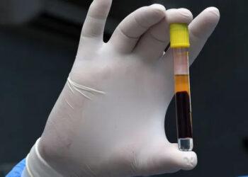 دراسة تكشف مفاجأة عن فيروس كورونا