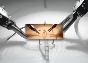 الذكاء الاصطناعي في الجراحة