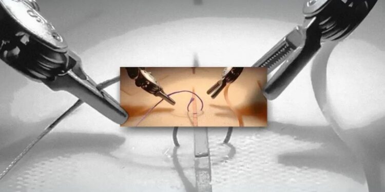 الذكاء الاصطناعي في الجراحة