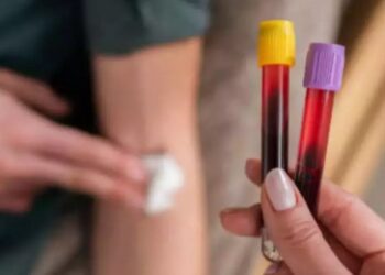 هل التبرع بالدم يسبب الأنيميا؟