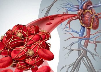 4 مشروبات طبيعية تحميك من خطر الجلطات المفاجئة وتحسن صحة قلبك