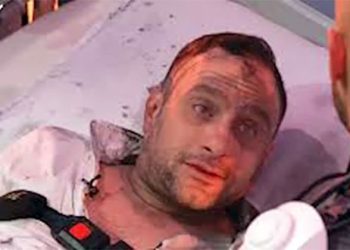 أول تعليق من حسام حبيب بعد حلقته في رامز إيلون مصر