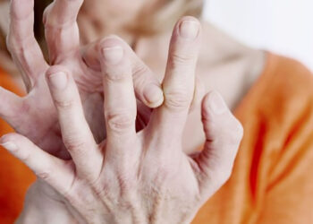 حسام موافي يكشف علامة في أصابع اليد تشير إلى مشكلة خطيرة بالقلب