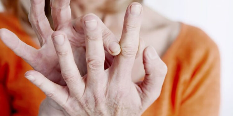 حسام موافي يكشف علامة في أصابع اليد تشير إلى مشكلة خطيرة بالقلب