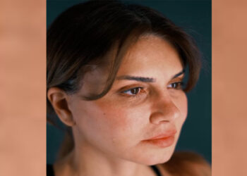 نجلاء بدر تثير الجدل بعد إجراء عملية تجميل وتغيير ملامحها