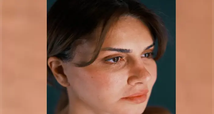 نجلاء بدر تثير الجدل بعد إجراء عملية تجميل وتغيير ملامحها