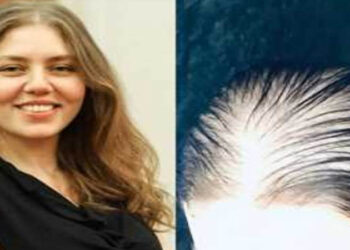 رحمة حسن ترفض اعتذار العياده المتسببة في سقوط شعرها