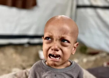 وفاة الطفل الفلسطيني صاحب مقولة “أنا جعان”