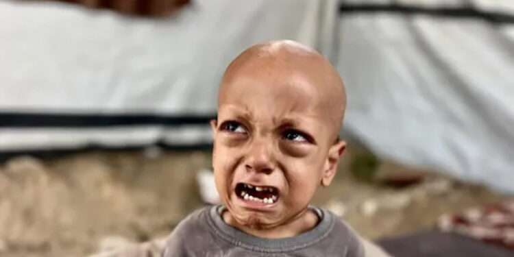 وفاة الطفل الفلسطيني صاحب مقولة “أنا جعان”