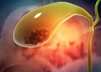 5 أعراض مبكرة قد تشير إلى مشاكل في المرارة