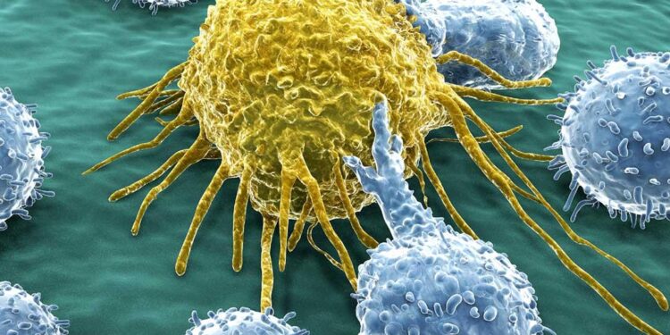 أهم 6 أسباب للإصابة بالسرطان.. وتحذير خاص للنساء