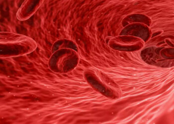 علامات أنيميا نقص الحديد وطرق علاجها وأسبابها