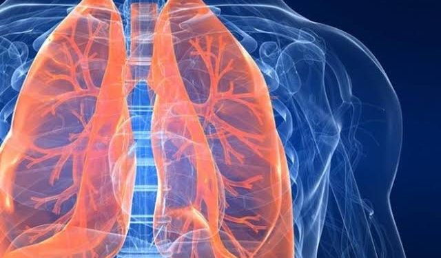 جلطة الرئة.. الأعراض والأسباب والفئات الأكثر عرضة للإصابة