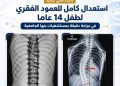التعليم العالي:  استعدال كامل للعمود الفقري لطفل 14 عامًا بمستشفيات جامعة بنها